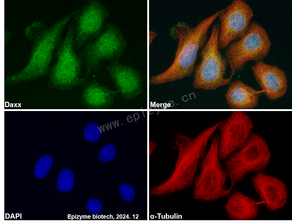 Anti-Daxx Rabbit mAb [23M45K41]
