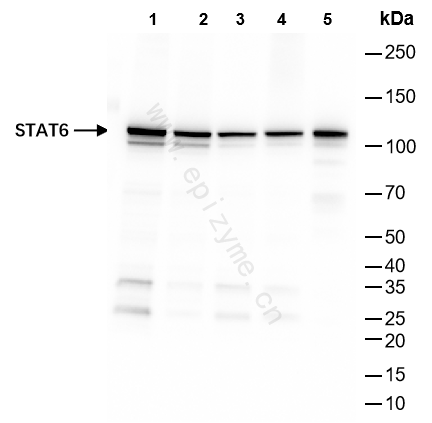 Anti-STAT6 Rabbit mAb [64L18L15]