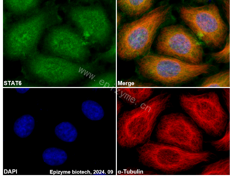 Anti-STAT6 Rabbit mAb [64L18L15]