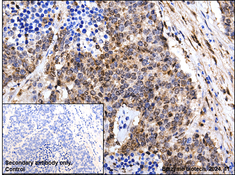 Anti-STAT6 Rabbit mAb [64L18L15]