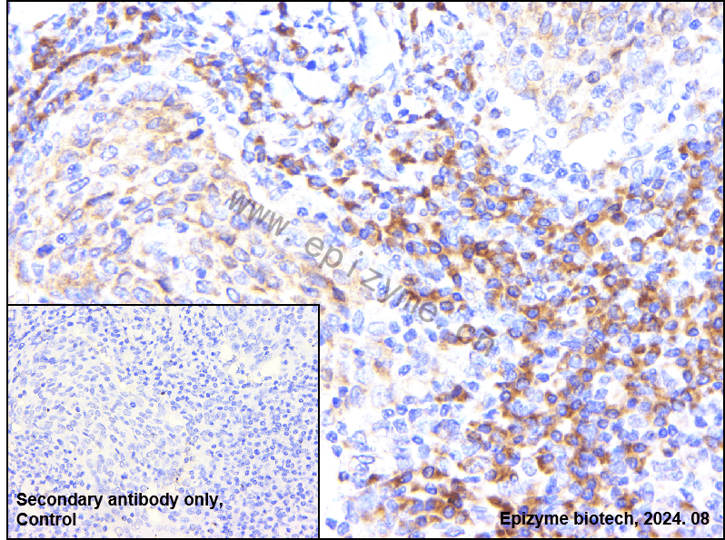 Anti-eIF4B Rabbit mAb [80M50K95]