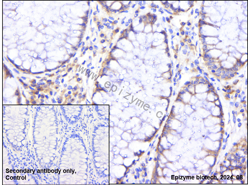 Anti-eIF4B Rabbit mAb [80M50K95]