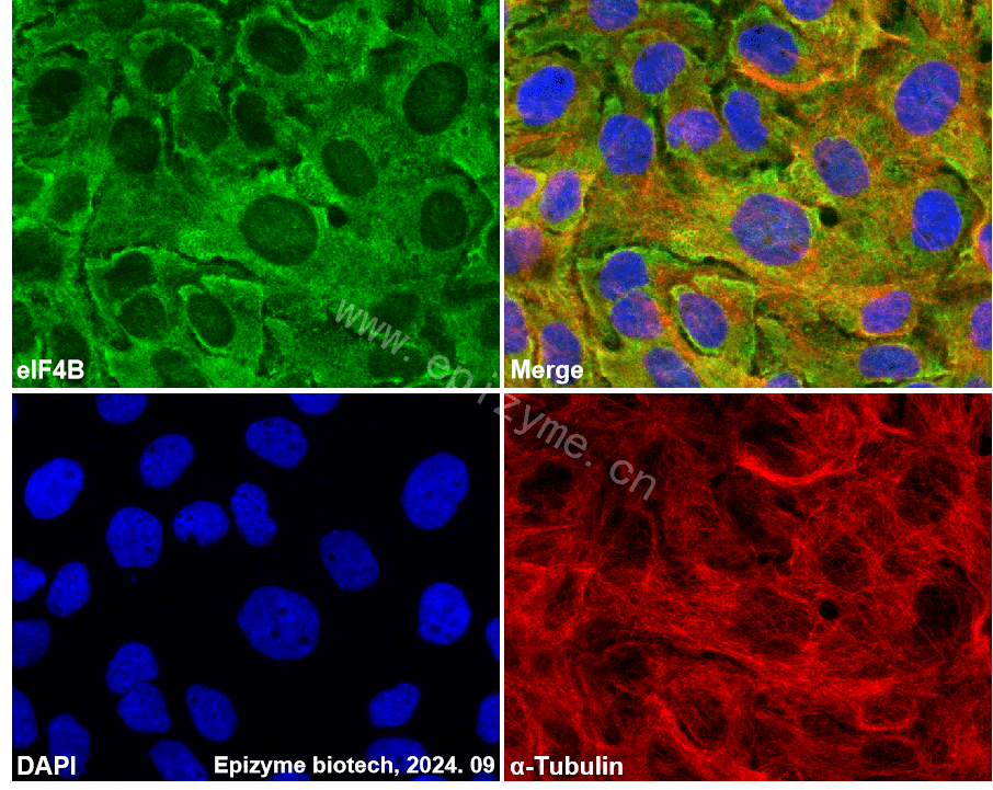 Anti-eIF4B Rabbit mAb [80M50K95]