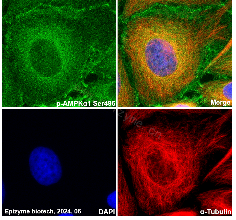 Anti-Phospho-AMPK alpha 1 (Ser496) Rabbit mAb [25M45K61]