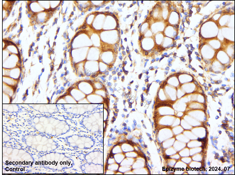 Anti-Phospho-AMPK alpha 1 (Ser496) Rabbit mAb [25M45K61]
