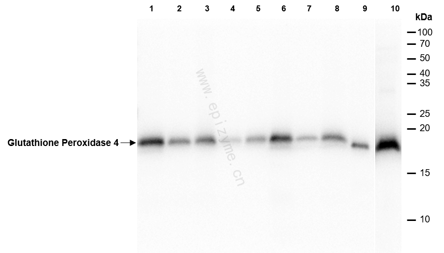 Anti-Glutathione Peroxidase 4 Rabbit mAb [82K58M44]