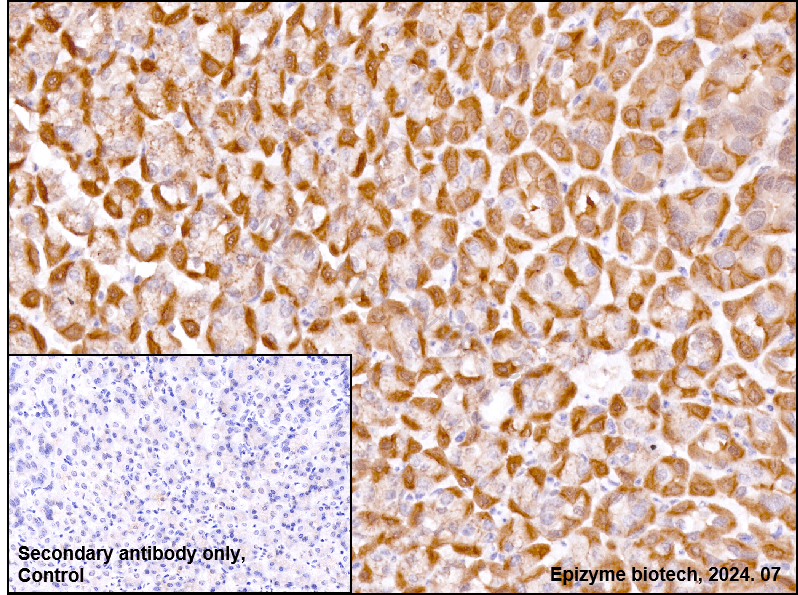 Anti-Glutathione Peroxidase 4 Rabbit mAb [82K58M44]