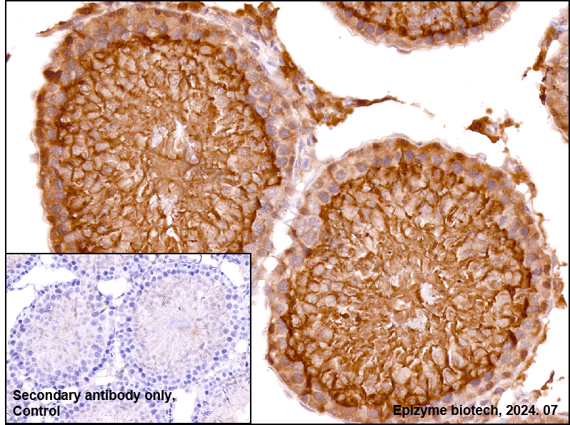 Anti-Glutathione Peroxidase 4 Rabbit mAb [82K58M44]
