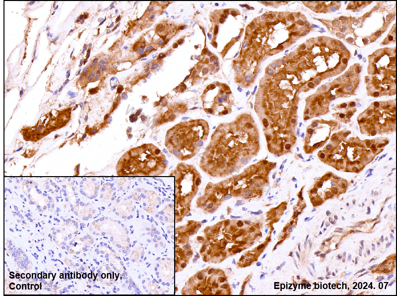 Anti-Glutathione Peroxidase 4 Rabbit mAb [82K58M44]