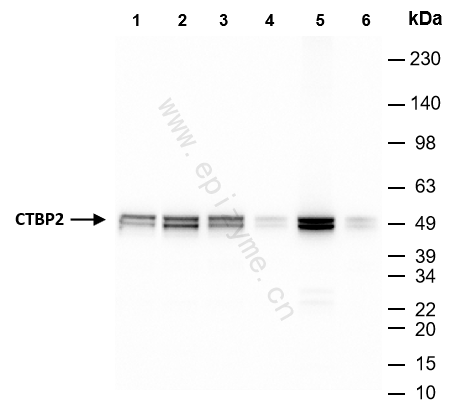Anti-CTBP2 Rabbit mAb [93M18K58]