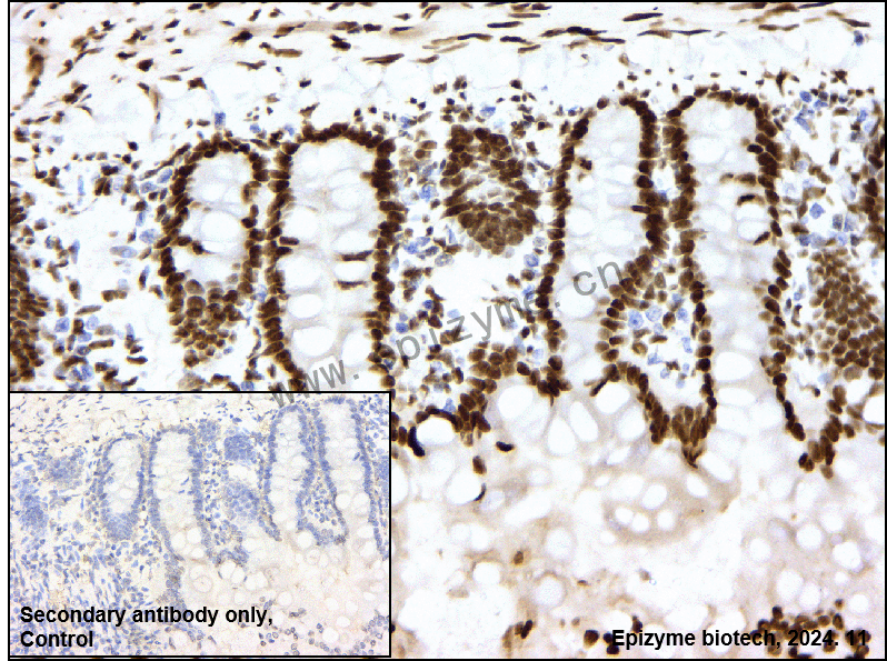 Anti-CTBP2 Rabbit mAb [93M18K58]