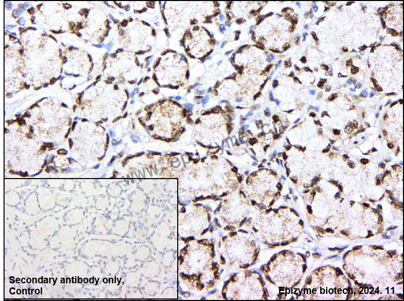 Anti-CTBP2 Rabbit mAb [93M18K58]