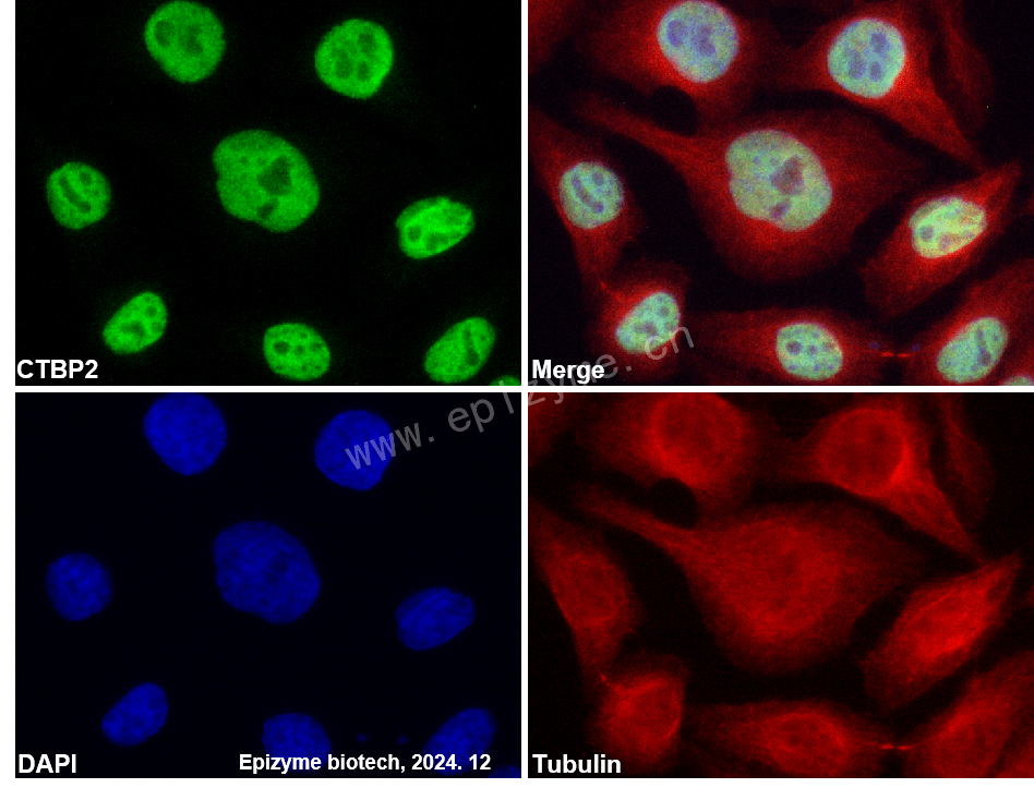 Anti-CTBP2 Rabbit mAb [93M18K58]