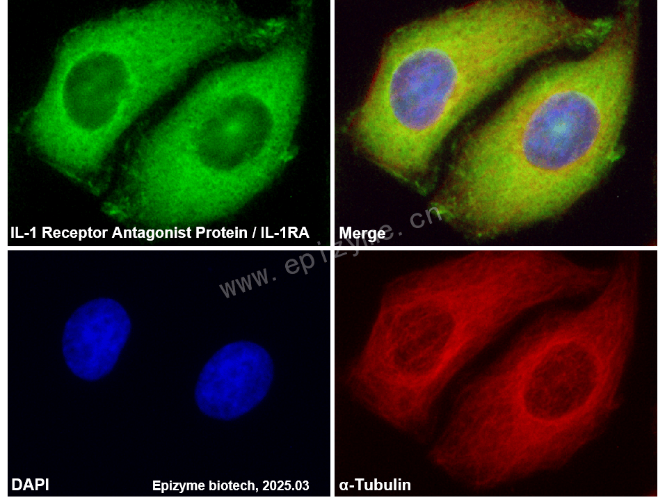 Anti-IL-1RA Rabbit mAb [65K93M28]