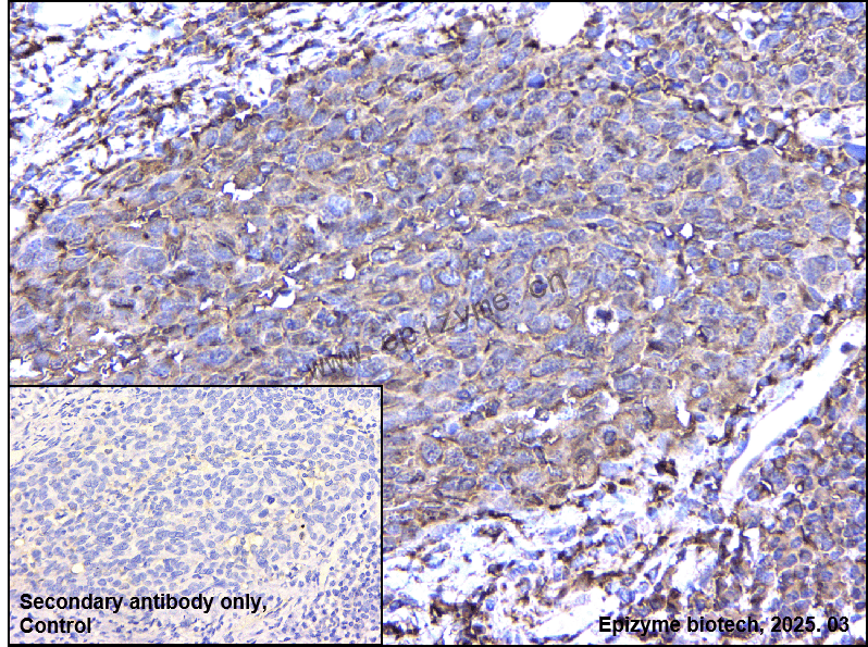 Anti-IL-1RA Rabbit mAb [65K93M28]