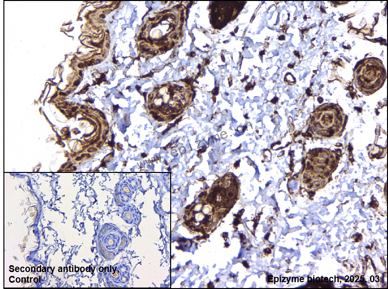 Anti-IL-1RA Rabbit mAb [65K93M28]