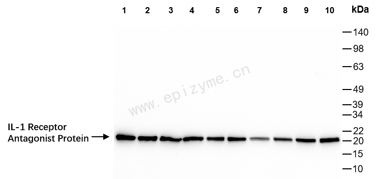 Anti-IL-1RA Rabbit mAb [65K93M28]