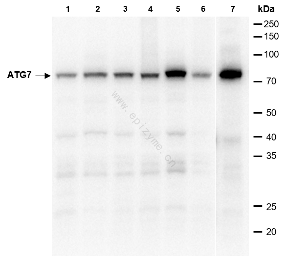 Anti-ATG7 Rabbit mAb [96L82K04]