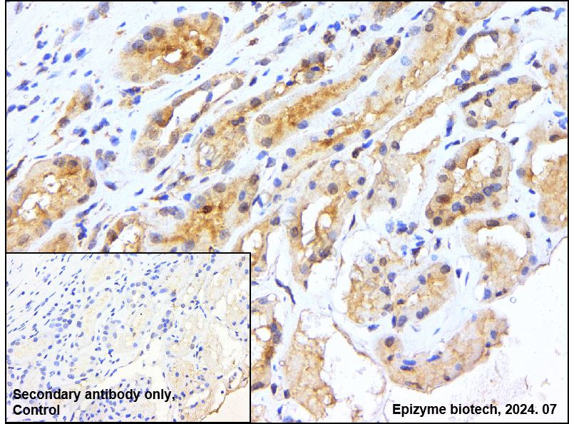 Anti-ATG7 Rabbit mAb [96L82K04]