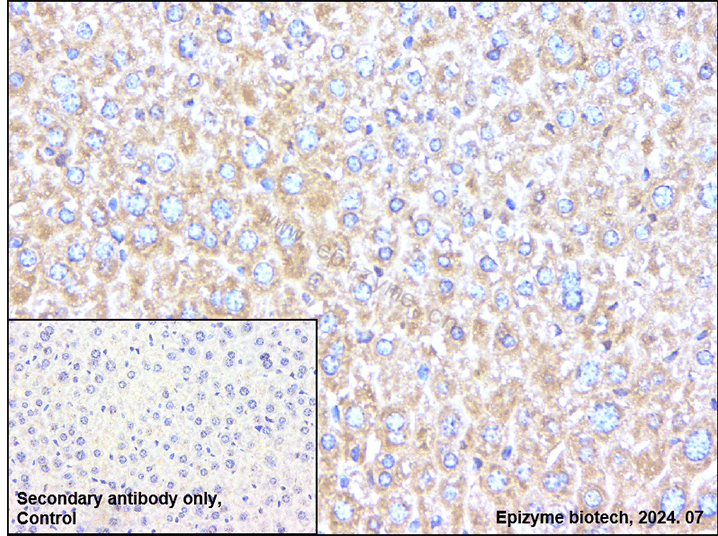 Anti-ATG7 Rabbit mAb [96L82K04]