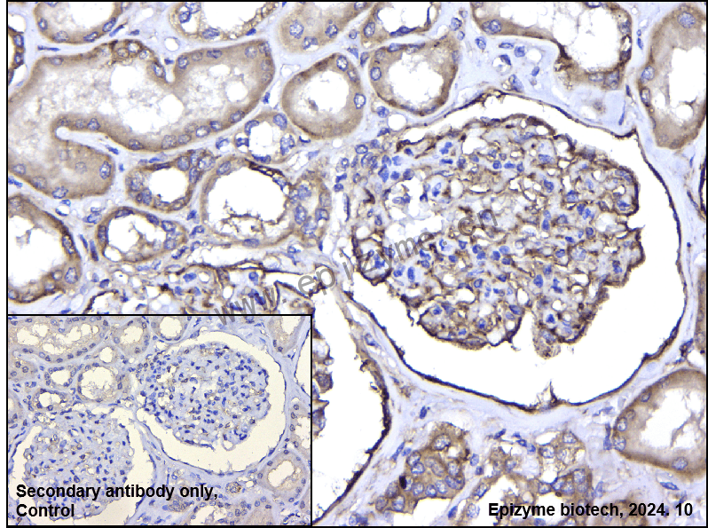 Anti-Integrin alpha V Rabbit mAb [29L34M99]