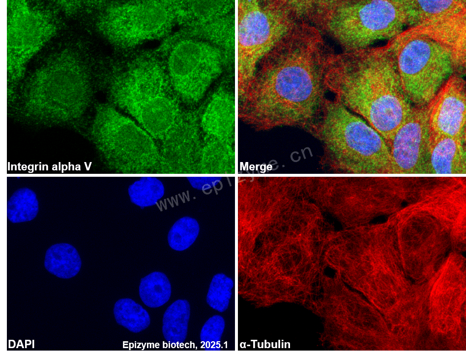 Anti-Integrin alpha V Rabbit mAb [29L34M99]