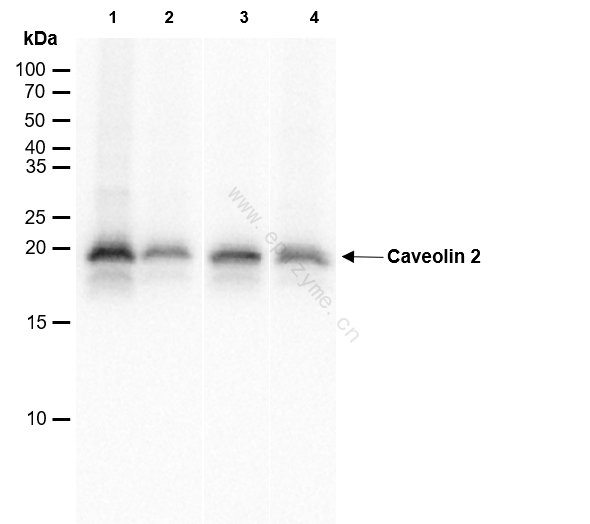 Anti-Caveolin 2 Rabbit mAb [18K76M38]