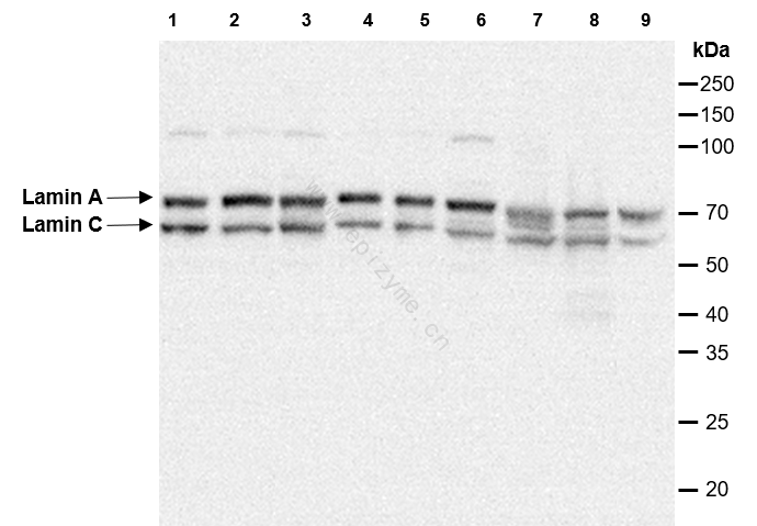 Anti-Lamin A/C Rabbit mAb [32K72K58]