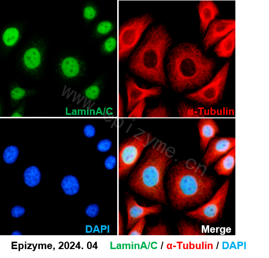 Anti-Lamin A/C Rabbit mAb [32K72K58]