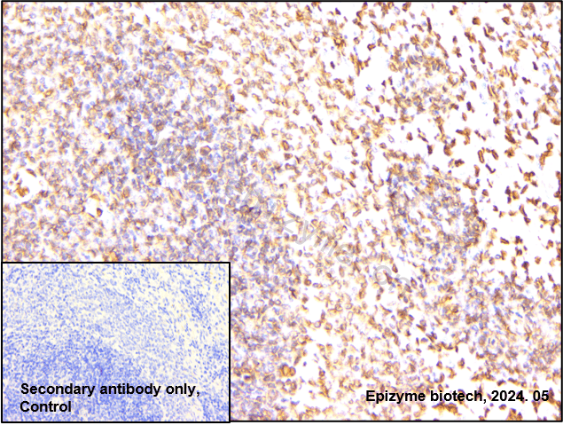 Anti-Lamin A/C Rabbit mAb [32K72K58]