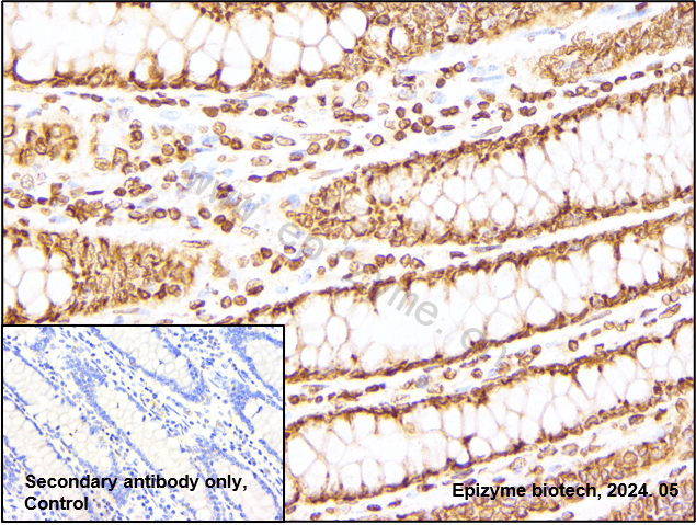 Anti-Lamin A/C Rabbit mAb [32K72K58]