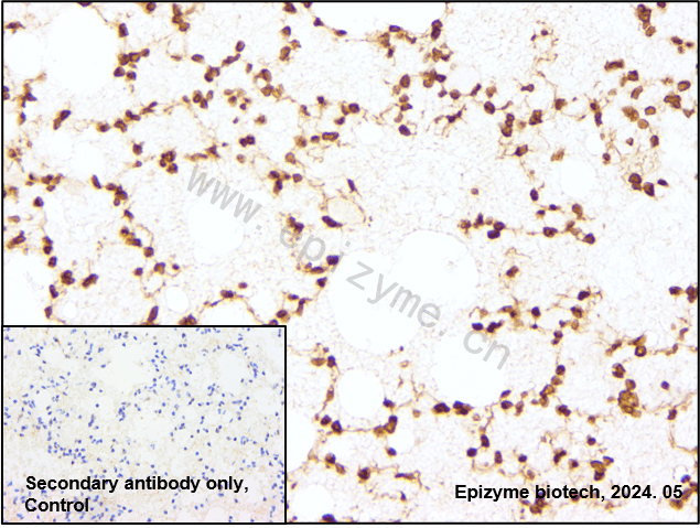 Anti-Lamin A/C Rabbit mAb [32K72K58]
