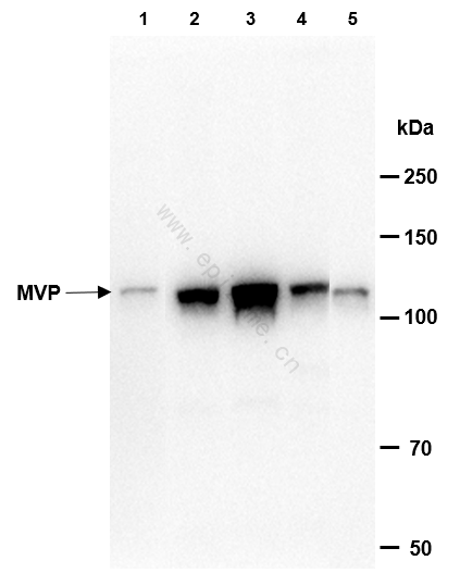 Anti-MVP Rabbit mAb [73K30L74]