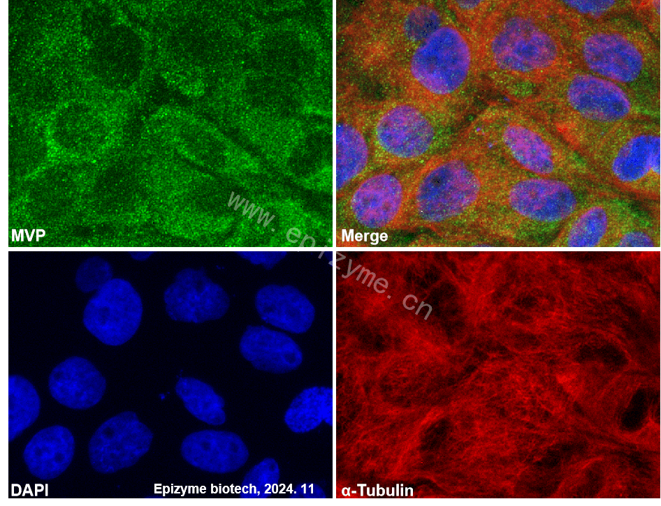 Anti-MVP Rabbit mAb [73K30L74]