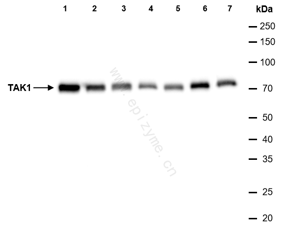 Anti-TAK1 Rabbit mAb [65K39K96]