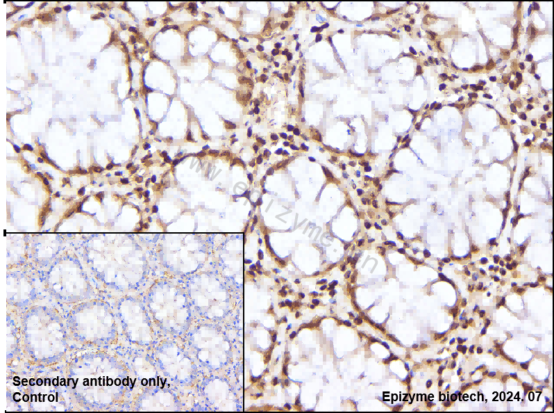 Anti-TAK1 Rabbit mAb [65K39K96]