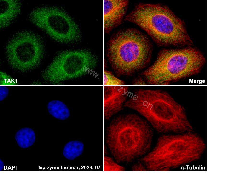 Anti-TAK1 Rabbit mAb [65K39K96]