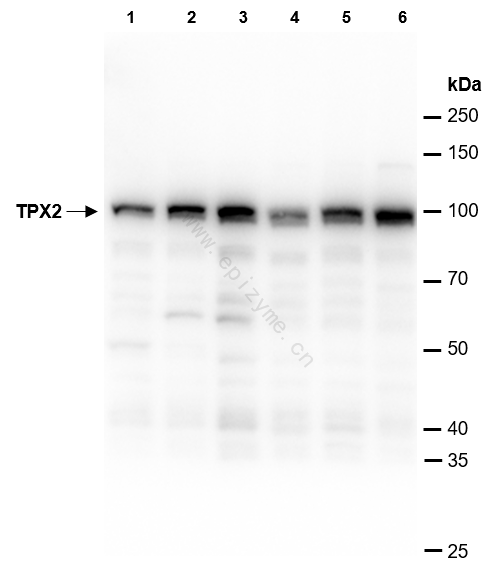 Anti-TPX2 Rabbit mAb [24K08L44]