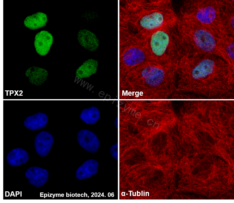 Anti-TPX2 Rabbit mAb [24K08L44]