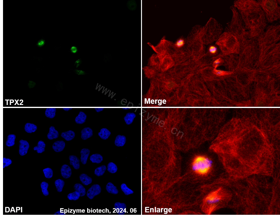 Anti-TPX2 Rabbit mAb [24K08L44]
