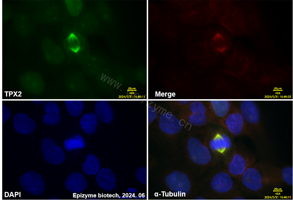 Anti-TPX2 Rabbit mAb [24K08L44]