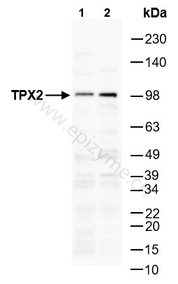 Anti-TPX2 Rabbit mAb [24K08L44]