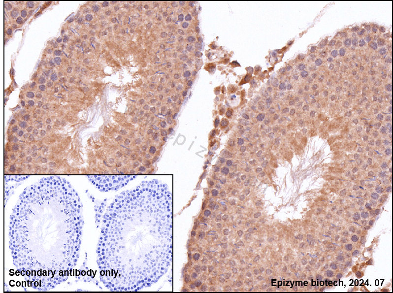 Anti-IL-4 Rabbit mAb [68L68L95]