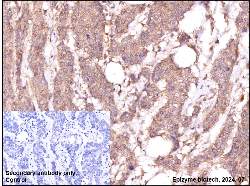 Anti-IL-4 Rabbit mAb [68L68L95]