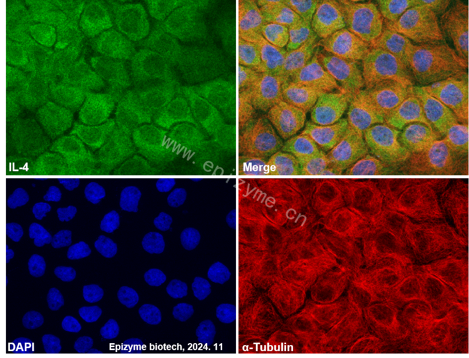 Anti-IL-4 Rabbit mAb [68L68L95]