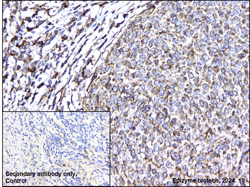 Anti-TEF1/TEAD-1 Rabbit mAb [81L51L45]