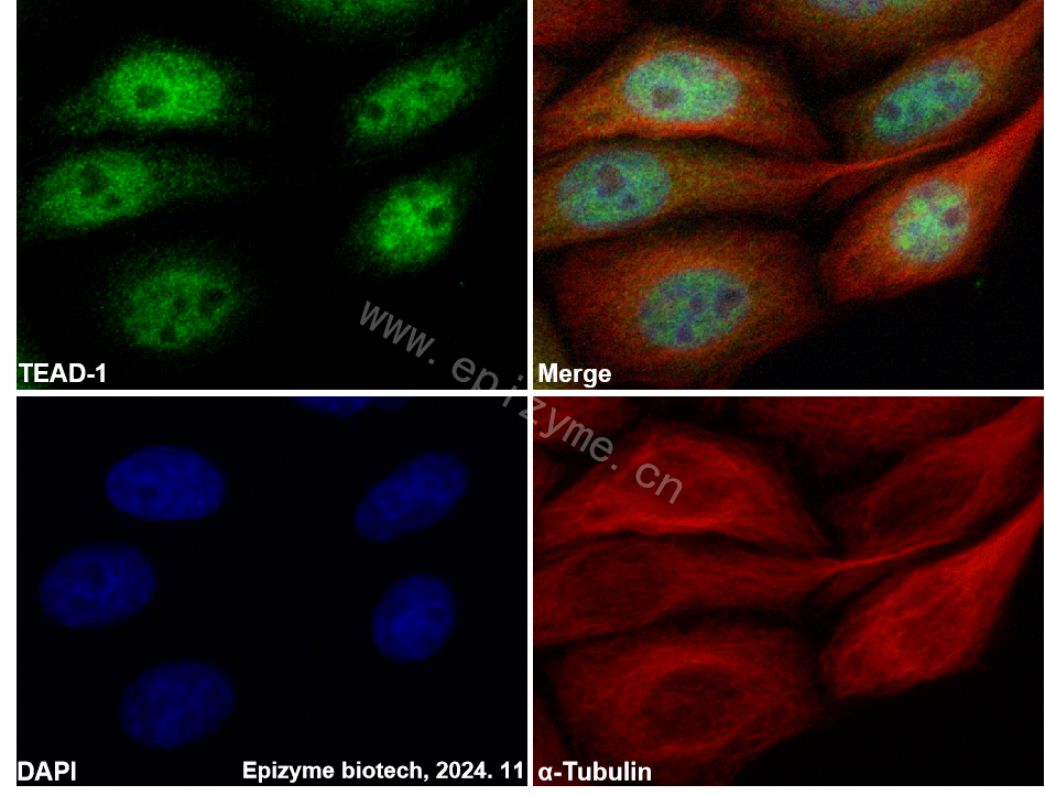 Anti-TEF1/TEAD-1 Rabbit mAb [81L51L45]