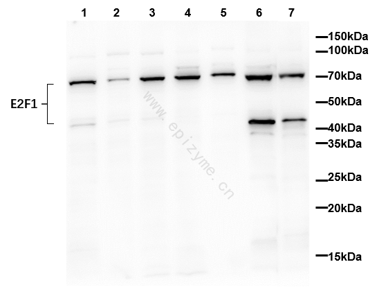 Anti-E2F1 Rabbit mAb [66L08K34]