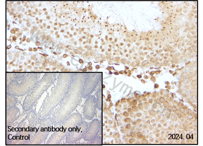 Anti-E2F1 Rabbit mAb [66L08K34]