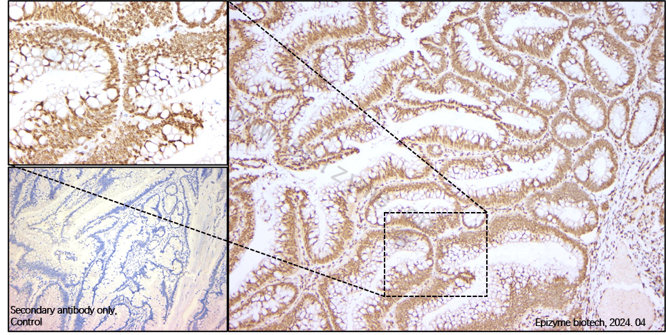Anti-E2F1 Rabbit mAb [66L08K34]